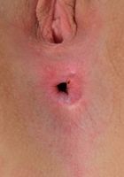 Alexa gapes her pink meat., Alexa Grace (ale152) ATK Premium: Alexa Grace (Alexa gapes her pink meat.)