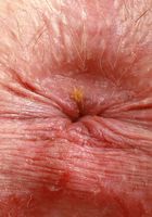 ATK Galleria: Alex Kane (Emo Girl Alex Kane First Spreads)