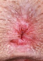 ATK Petites: Ali Jones (Ali Jones All Nude and Spreading)