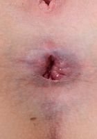 Alyce Anderson in amateur, Alyce Anderson (aly027) ATK Premium: Alyce Anderson (Alyce Anderson in amateur)