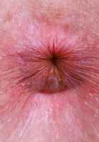 ATK Natural & Hairy: Apricot Pitts (Apricot Pitts' panties tell the whole juicy story)