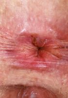 Apricot Pitts from ATK Natural & Hairy