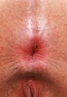 Bess Breast Outdoor Nudity, Bess Breast (bes004) ATK Natural & Hairy: Bess Breast (Bess Breast Outdoor Nudity)