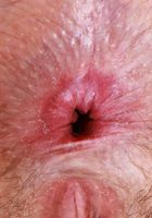 ATK Petites: Big Eyes (Big Eyes Says Cover All or Cover None)