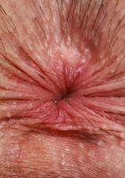 ATK Galleria: Daydream Daisy (Daydream Daisy has what you need)