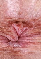 ATK Galleria: Dolly Paige (Dolly Paige Loves to Show Pink Pussy)