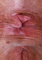 ATK Galleria: Dolly Paige (Dolly Paige is super cute in her pink dress)