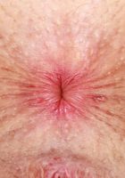 ATK Natural & Hairy: Fiona Peaches (Fiona Peaches is in a lovely mood)