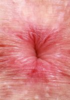 ATK Petites: Fiona Sprouts (Fiona Peaches shows it off)