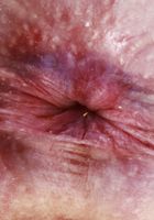 Hazel Paige Outdoor Nudity, Hazel Paige (haz017) ATK Petites: Hazel Paige (Hazel Paige Outdoor Nudity)