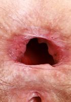 Jackie Hoff from ATK Natural & Hairy