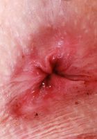 Kallie Taylor Slow Striptease & Spreading, Kallie Taylor (kal019) ATK Petites: Kallie Taylor (Kallie Taylor Slow Striptease & Spreading)