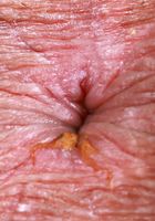 ATK Petites: Leila Mills (Leila Mills is as cute as a button)