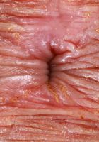 ATK Petites: Leila Mills (Leila Mills poses in some sexy lingerie)