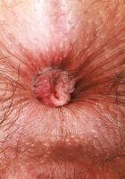Lucy Sunflower Plays with her Pubes Outdoors, Lucy Sunflower (luc110) ATK Natural & Hairy: Lucy Sunflower (Lucy Sunflower Plays with her Pubes Outdoors)