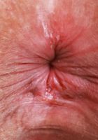 ATK Natural & Hairy: Remi Ferdinand (Remi Ferdinand Dress Strip Outdoors)