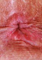 Sonny Mckinley from ATK Galleria