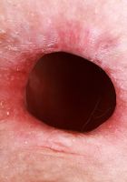 ATK Galleria: Storm Rose (Storm Rose Gapes Both Holes)